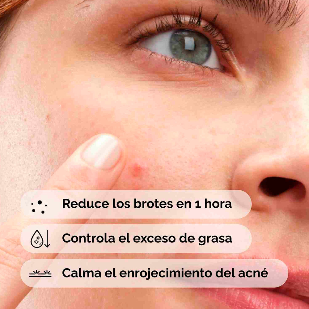 The Ordinary - Sulfur 10% Powder to Cream Concentrate - Imagen 3