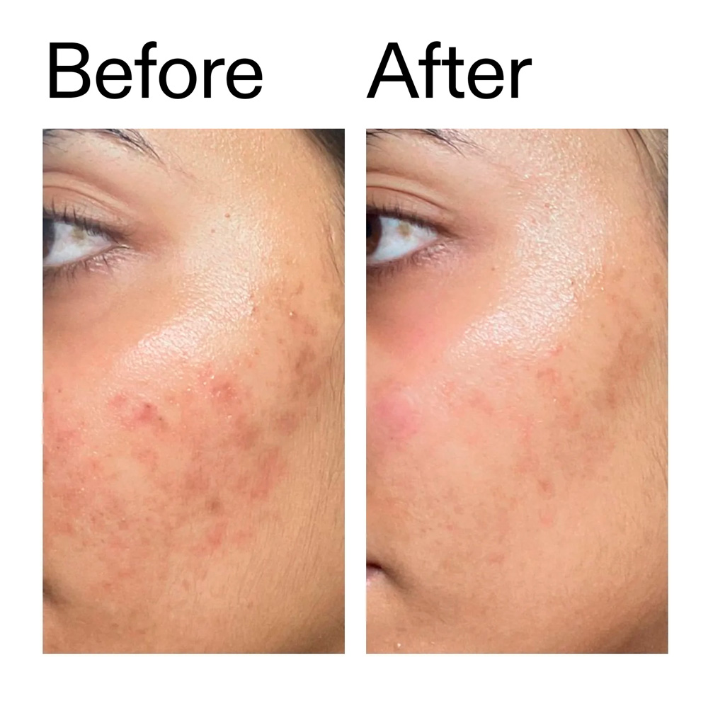 The Inkey List - Ectoin Hydro-Barrier Serum (30ml) - Imagen 4